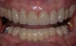 Healthy bright smile after dental treatment