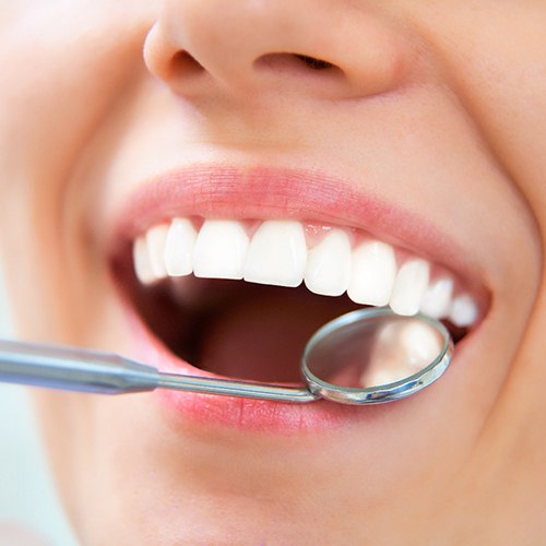 Dentist looking in a patient’s mouth