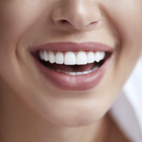 Closeup of bright smile after teeth whitening