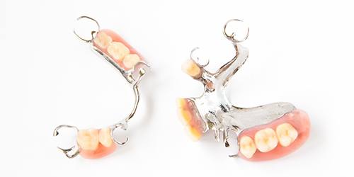 Two types of partial dentures