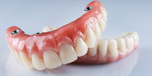 A pair of implant dentures
