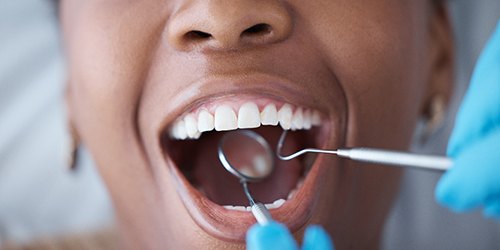 a woman having her teeth cleaned by a dental hygienist