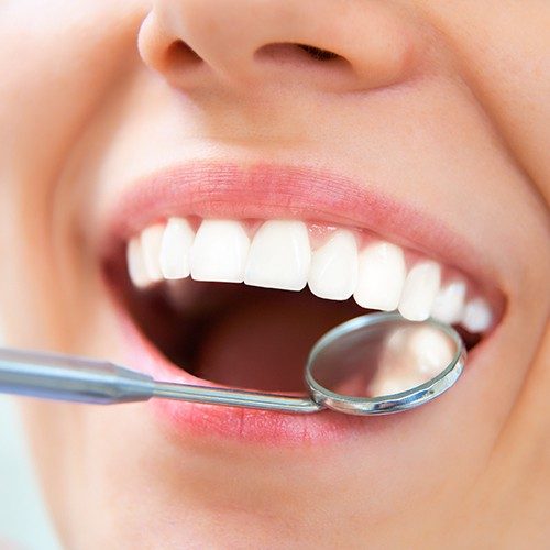 Dentist examining patient's smile after tooth colored filling restoration