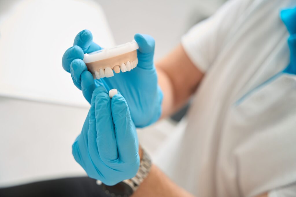 Dentist in blue gloves placing sample crown over model tooth